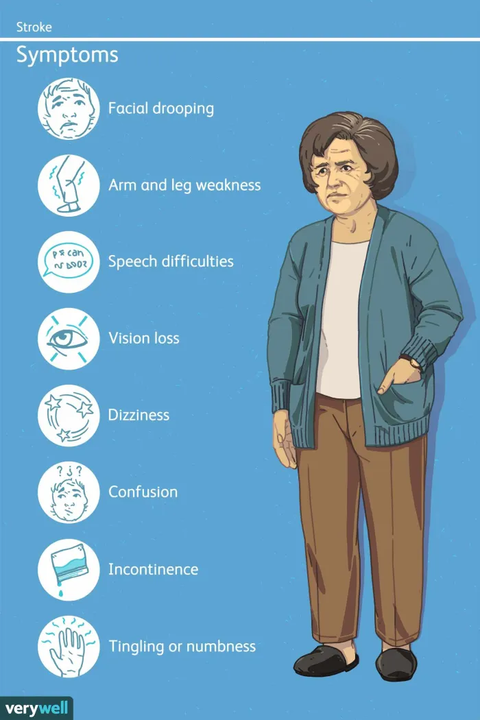 Warning Signs Of Stroke You Shouldn’t Ignore