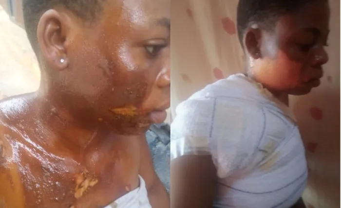 Madam Tortures HouseGirl With Hot Water