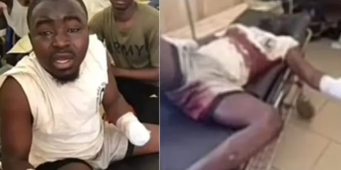 Wahala!! Wife Cut Off Husband Hand Because E Buy iPhone 16 for Side Chick