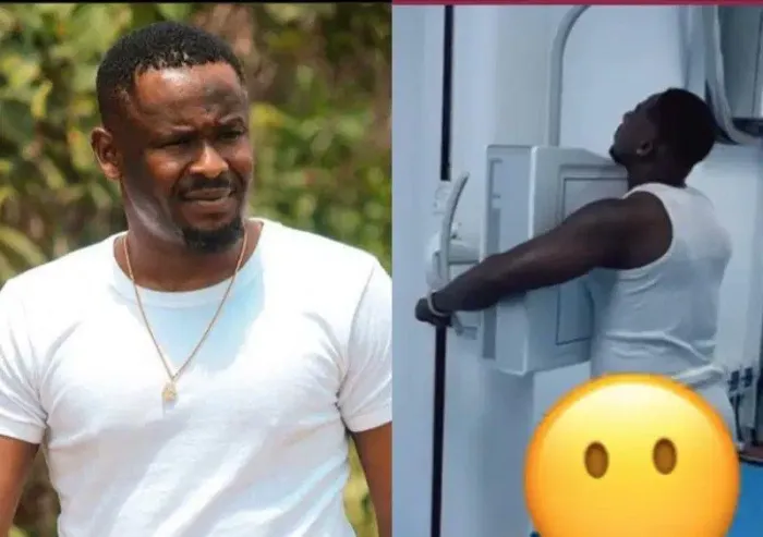 Nollywood Actor Godwin Nnadiekwe Hospitalised After On-Set Incident with Zubby Michael