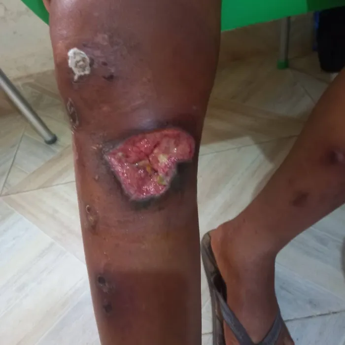 Female League Star Ifeoma Onwuegbuchulam Requires N3.5m for Life-Saving Surgery After Devastating Accident