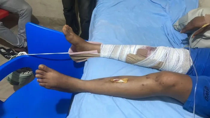 Female League Star Ifeoma Onwuegbuchulam Requires N3.5m for Life-Saving Surgery After Devastating Accident